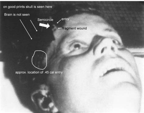 leaked autopsy photos|JFK Autopsy Photos (HD) : Free Download, Borrow,。